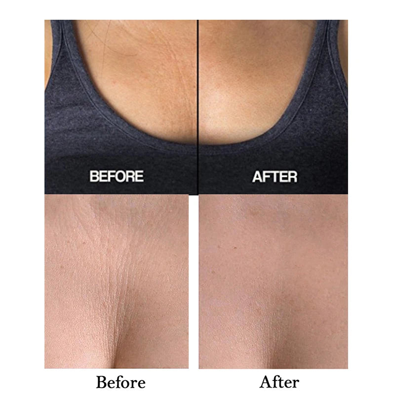 Reusable Silicone Anti-Wrinkle Chest Pads - Self-Adhesive Lift Patches for Neck and Chest Care