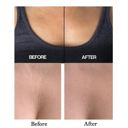 Reusable Silicone Anti-Wrinkle Chest Pads - Self-Adhesive Lift Patches for Neck and Chest Care